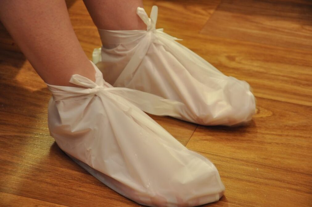 oblozi za artrozu gležnja