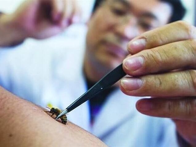 apiterapija cervikalne osteohondroze